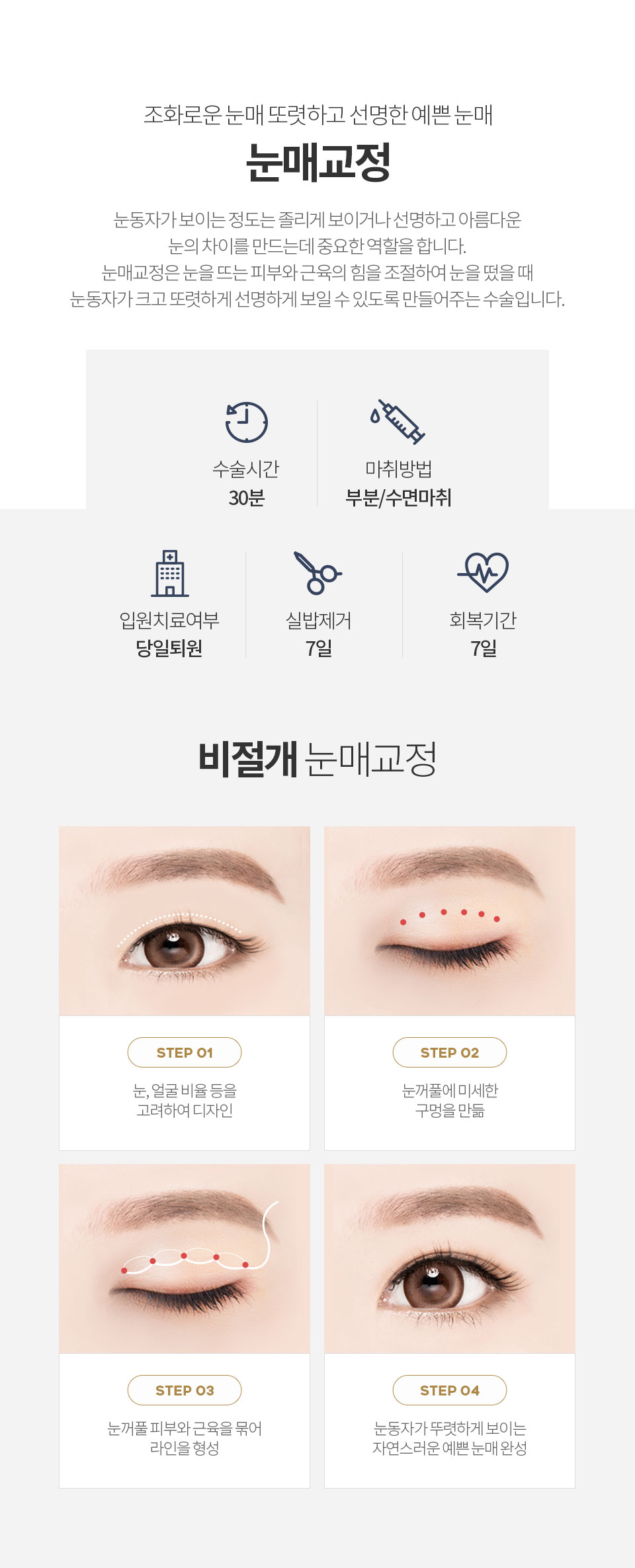 절개눈매교정 